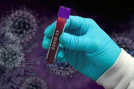 portalR7's tweet image. Brasil é 2º com maior número de curados da covid-19 no mundo  r7.com/N0bg