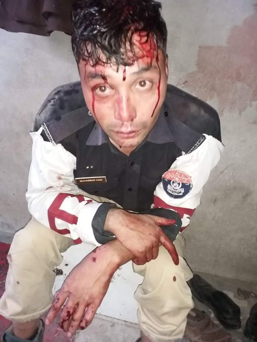 Aliakberkhan7's tweet photo. #justiceforhadi 
#justicForHadi
On duty traffic constable muhammad hadi has been brutally attacked by the voilent pashtoon groups quetta https://t.co/jrEDJadpvi