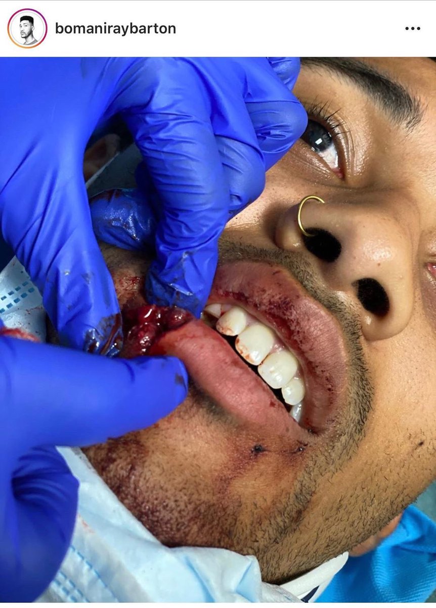 My friend just sent this to me from AUSTIN .. THEY ARE A NOT A FUCKING JOKE . Teeth knocked out . Fracture jaw .