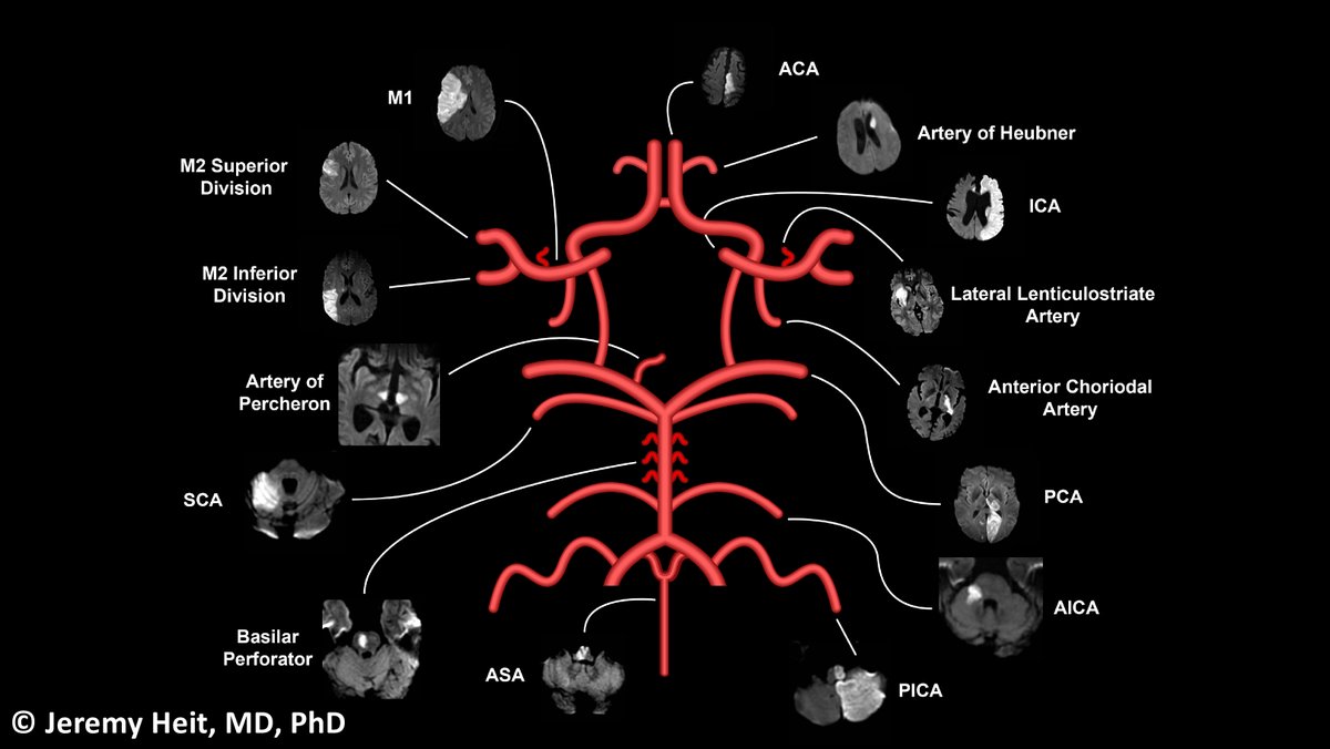 In sum,  @JeremyHeitMDPHD 's AMAZING figureWhat should I cover next  #MedTwitter? #Endneurophobia 