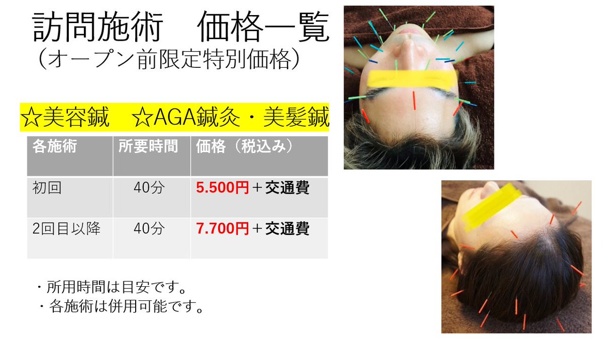 男性美容鍼 男性美容鍼