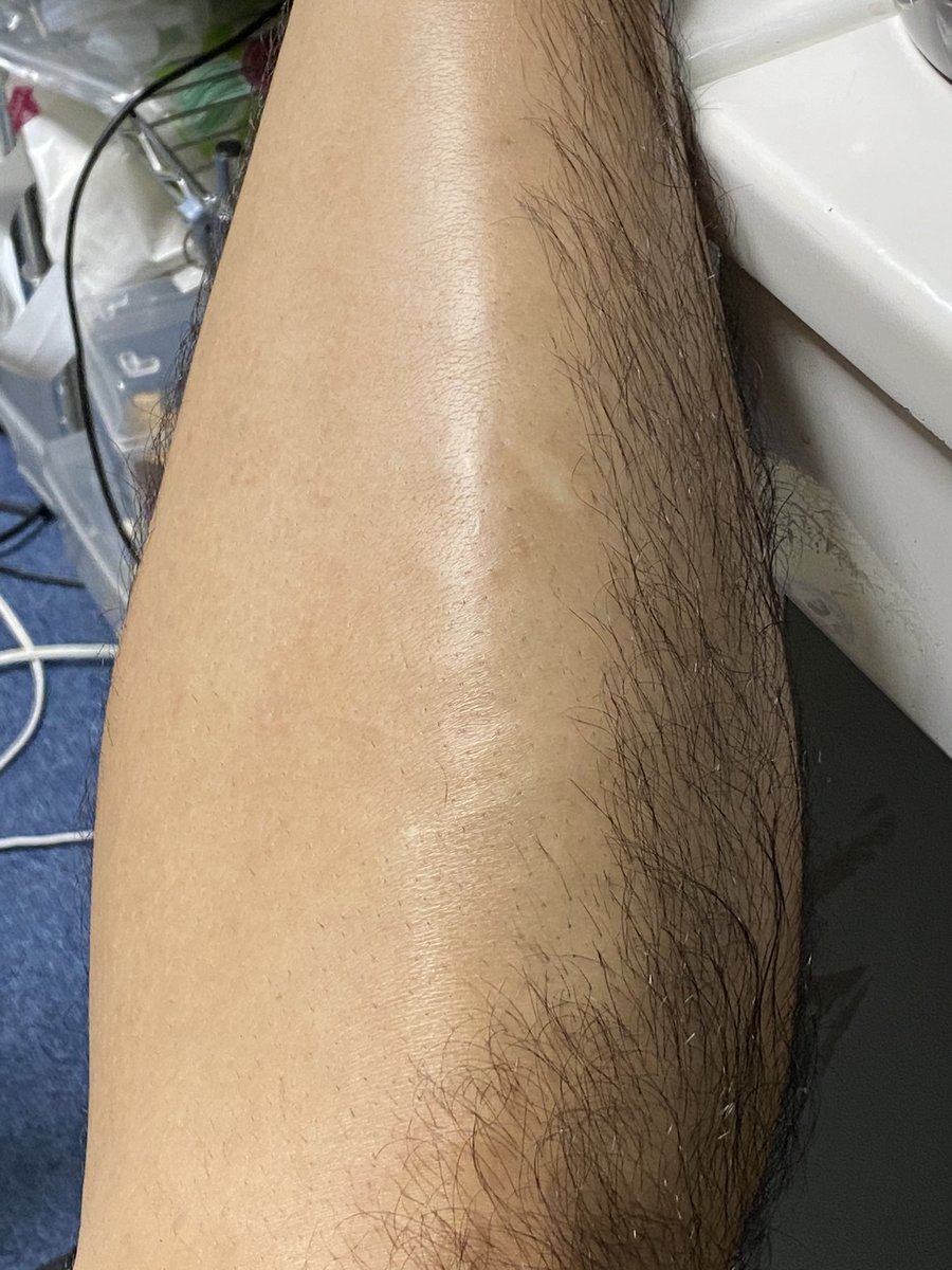 Soguresu 肌荒れはしない感じやねぇ トリマーとかは試した事ないや