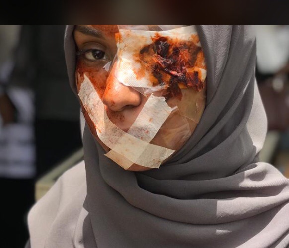 M00R_7's tweet photo. الثريد دا حأنزل فيه شغلي في مجال المكياج السينمائيsfxmakeup اللي هو فن بيستخدم للحصول على مؤثرات سينمائيه مثلاً في الافلام او تجسيد معاناه معينه من عنف وغيرو بسم الله نبدأ قوي قلبك وخش شوف الفن ولايك وريتويت لو عجبك شغلي وعندي اكاونت في الانستا الرابط في البايو💕💕💕💕 https://t.co/8jVXZyFqQN