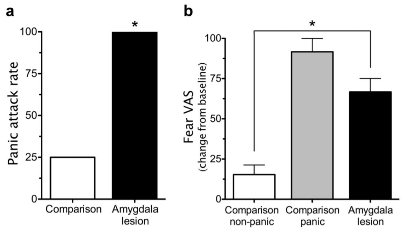 9 – *But* normal subjects with intact amygdalas did not panic with CO2 inhalation. Because they knew that the threat was artificial. This research uncovered a central role for the amygdala in telling the difference between a mock versus real external threat.
