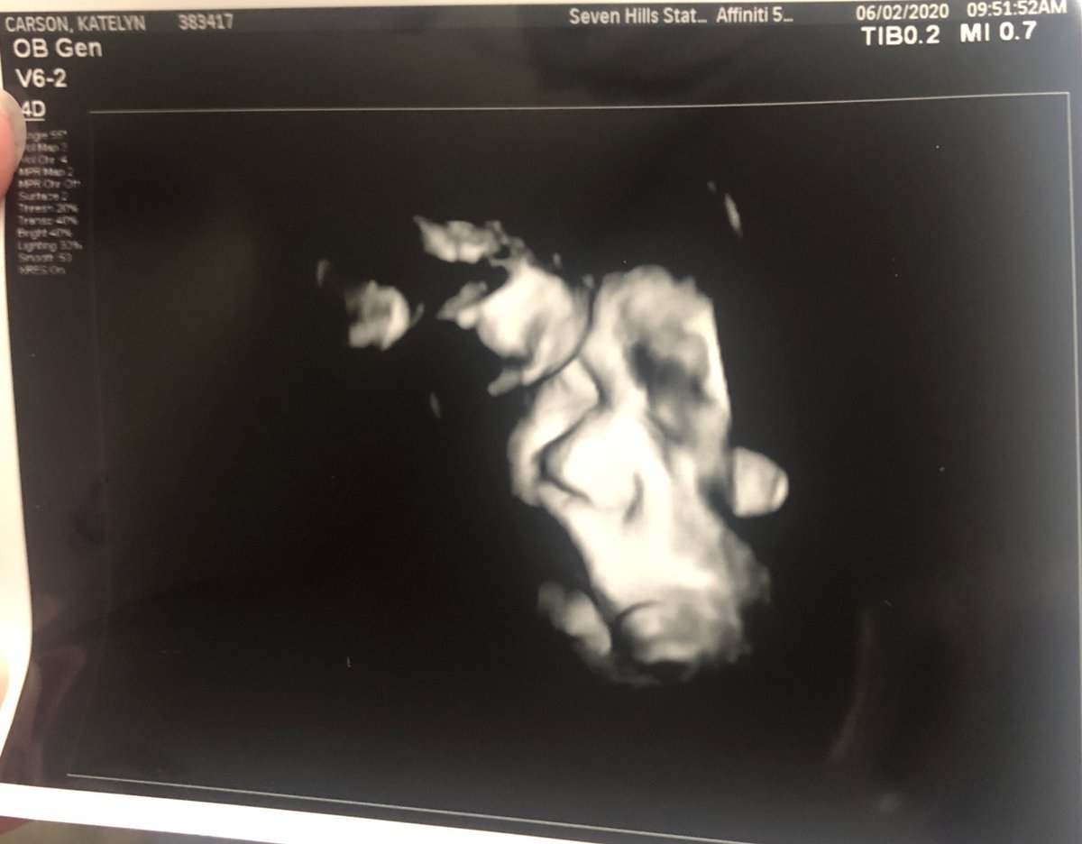 KKlayer's tweet image. 1 WEEK🥺🥰💚