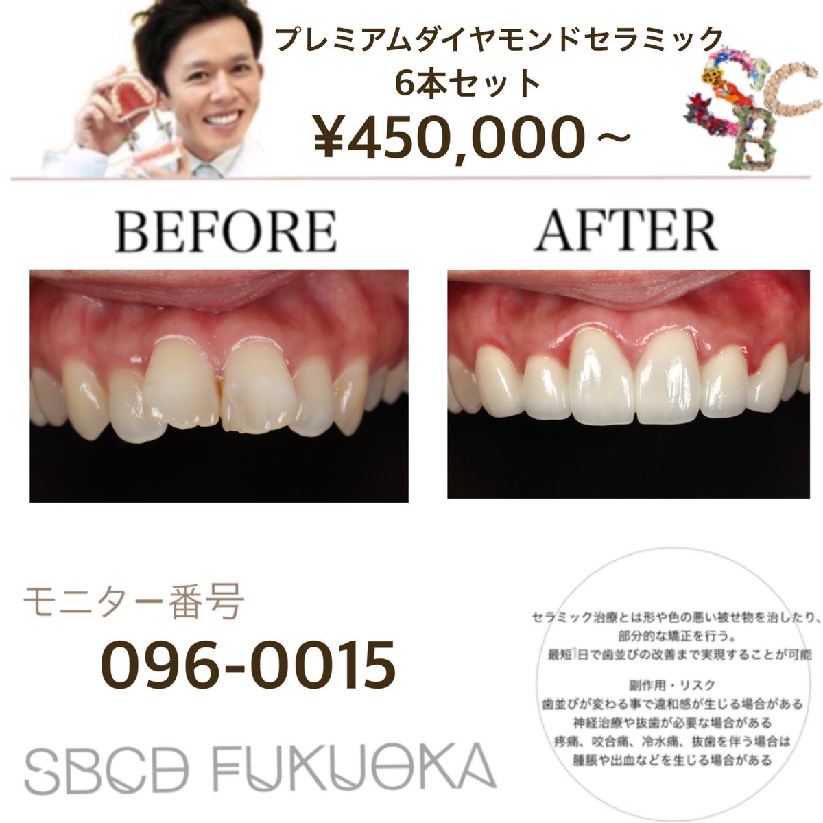 湘南美容歯科 福岡院 Sur Twitter ６月より新価格に改訂 おやすくなりました 綺麗な歯 ホワイトニング コンプレックス セラミック 福岡