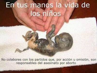 #AbortoNoEsSalud una imagen vale más que mil palabras....#AbortoEsUnCrimen #NoAlAborto #SalvemosLas2Vidas @DiputadosAR @Diputados_Todos @prodiputados