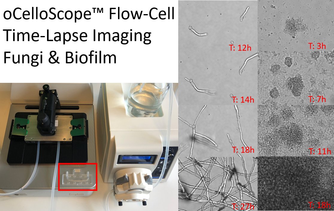 BioSenseSoluti1's tweet photo. You can now use flow-cells with your oCelloScope to study non-static kinetics and morphology in fungi, bacteria and biofilm 

#biofilm #microbiology #fungi #AntimicrobialResistance https://t.co/k187tEQ7yU