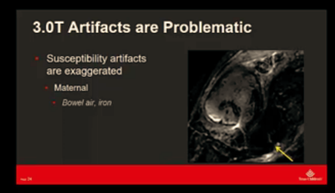 The_ASPNR's tweet photo. Dr. Nilesh Desai of @TCHRadiology made his case for why 1.5T is preferred over 3T for #fetalMRI at #ASNR20. #pedineurorad #neurorad #pedsrad #fetal @Fetal_Imaging @TCHFetalCenter @SocPedRad https://t.co/lkW12JjZ6l