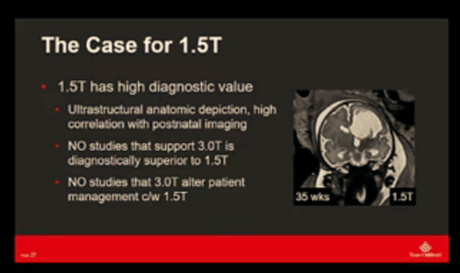 The_ASPNR's tweet photo. Dr. Nilesh Desai of @TCHRadiology made his case for why 1.5T is preferred over 3T for #fetalMRI at #ASNR20. #pedineurorad #neurorad #pedsrad #fetal @Fetal_Imaging @TCHFetalCenter @SocPedRad https://t.co/lkW12JjZ6l