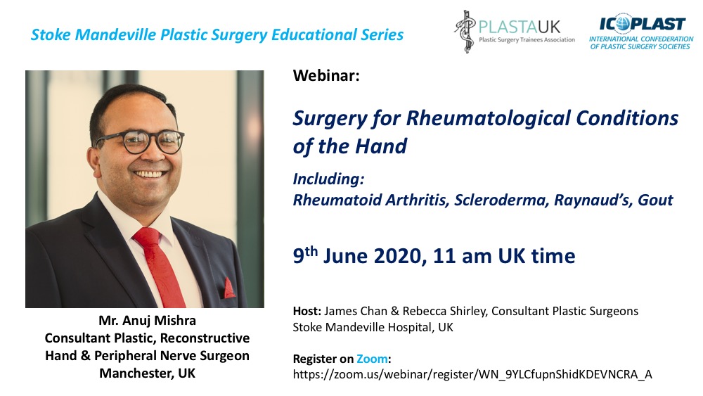 DrJamesKKChan's tweet image. SMH #Plasticsurgery series continues nxt Tue 9th Jun - Surgery for the Rheumatological Hand - join us here:
zoom.us/webinar/regist…  

@PLASTAUK @plasticstrainee @ICOPLASTsurgery @BSSHand @BAPRASvoice @BHTMedEd @rebecca5hirley @AcademicBucks @FESSHEurope @IFSSHand @The_Pulvertaft