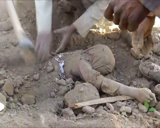 anonymousirania's tweet photo. I wish people weren't so selective in where the violation of human rights takes place. 
Cause maybe then they would see #Yemen https://t.co/1XzO6eCqfs