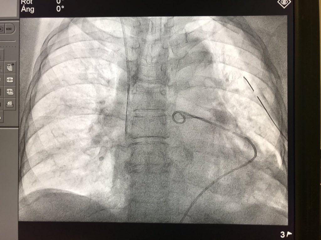 Alberto Fuensalida MD tweet media