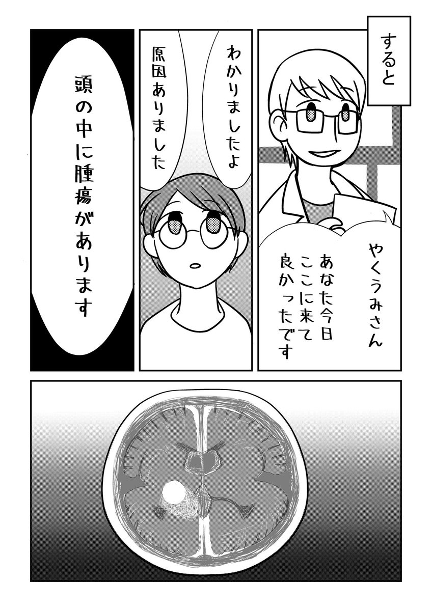聴神経腫瘍