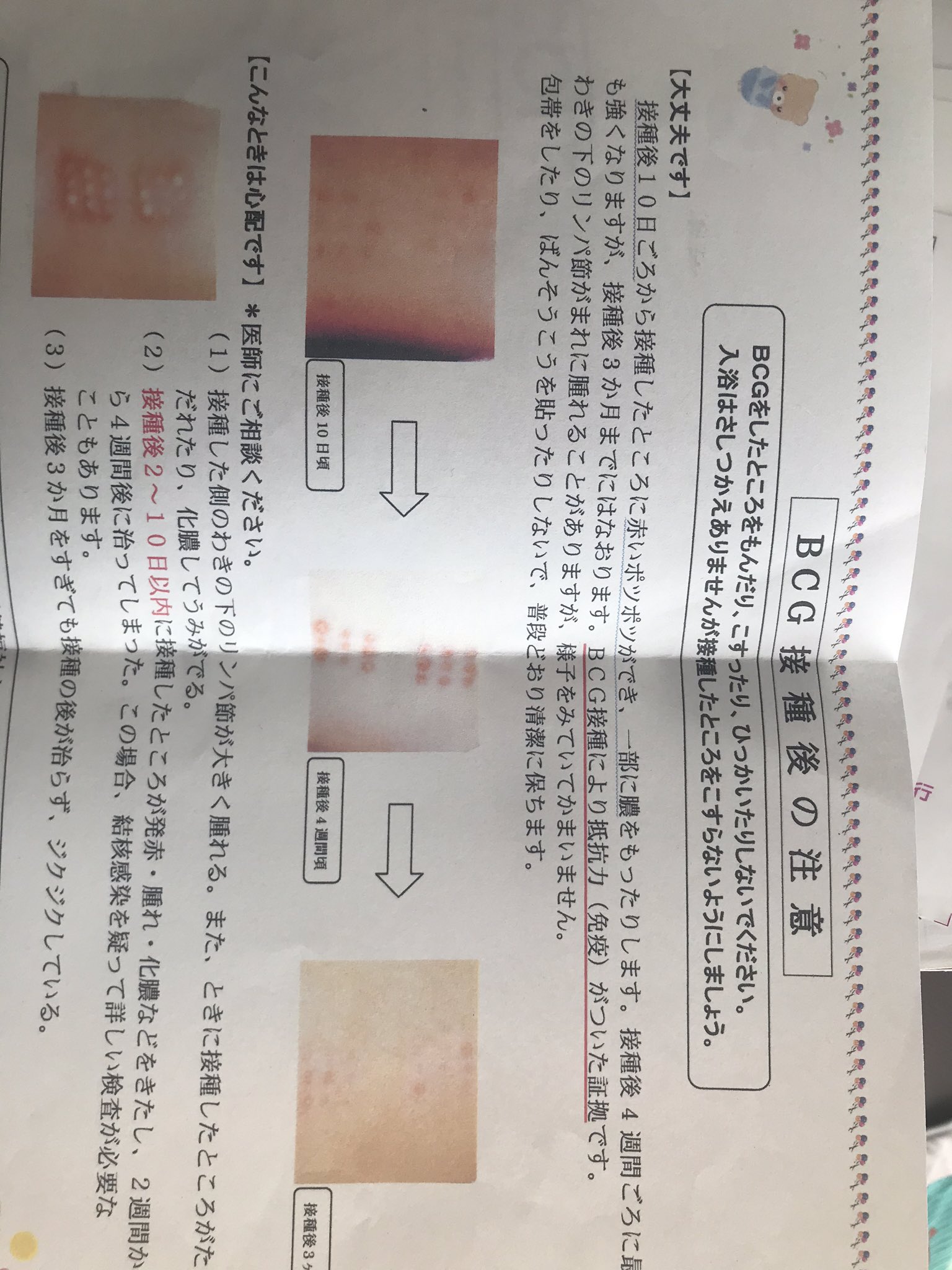 らむ 2y 11m Yumeho Com あるのでタメ語で失礼します これbcg打った時に貰った紙 白い芯て多分膿じゃないかな 左下の写真が膿が出てる例だからそれっぽかったら病院行った方がいいかも T Co Fgmqnu5t9e Twitter