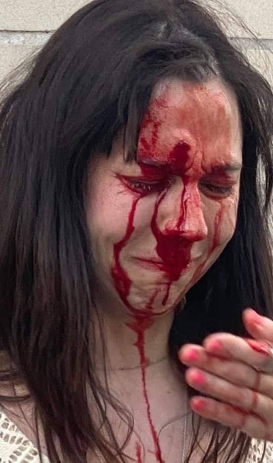 stivenjpelaez's tweet photo. "Las balas de goma" qué son usadas contra los manifestantes y NO manifestantes".
Esta es la triste realidad de como están actuando las policías en #EstadosUnidos
#Anonymous #AmericaConTrump #TrumpOut2020 #Covid_19 #Protestas2020 https://t.co/FjcyHxXZZx