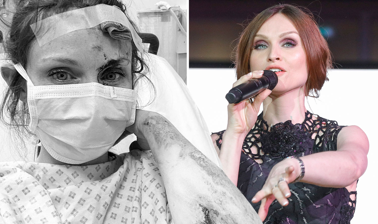 “BREAKING: Sophie Ellis-Bextor hospitalised after ‘gory’ bike accident leav...