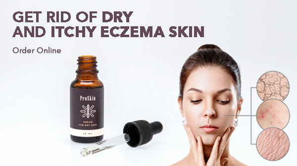dermedco's tweet photo. Eczema could show up in several places on your body. It is on the face, it causes skin red, scaling, and patchiness.  
ProSkin is for all skin types to treat eczema in the best possible way. 
Order online from our website.
https://t.co/1Ih6c9MUEG

 #eczema #eczemarelief https://t.co/2AGMWwgEEz