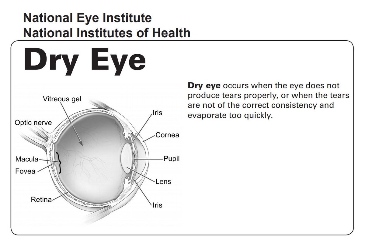 TheEyeGuys's tweet image. Dry eye can be more than just a minor annoyance. Click the link to read more about the causes and treatments of dry eye. Call us with questions or to set up an appointment.
#fishbaughfamilyeyecare #theyearofperfectvision #dryeye

nei.nih.gov/sites/default/…