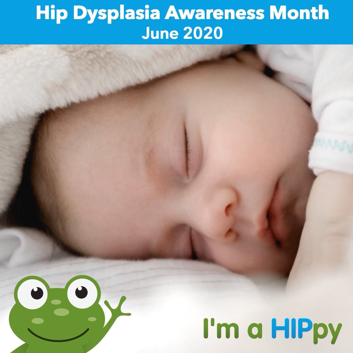 Babies should have their hips checked at: Birth, 4-8 weeks, 6-9 months, 1 year, At check ups until age 3. 
The International Hip Dysplasia study found that in babies diagnosed before the age of 6 months, 79% were treated successfully without surgery. #hipdysplasiaawarenessmonth