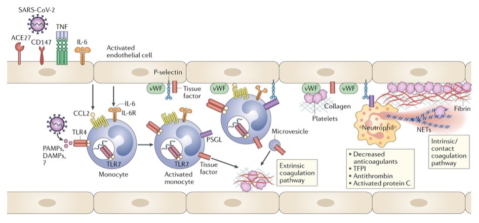 mmw_lmw's tweet photo. #COVID19 | a key role for monocytes and macrophages in pathological inflammation | contribution to @Coagulation | Miriam Merad @IcahnMountSinai &amp; Jerome Martin @UnivNantes @NatRevImmunol https://t.co/7z2wJB11Uj | #2020_ReCapMay https://t.co/Cq6yO7jtar