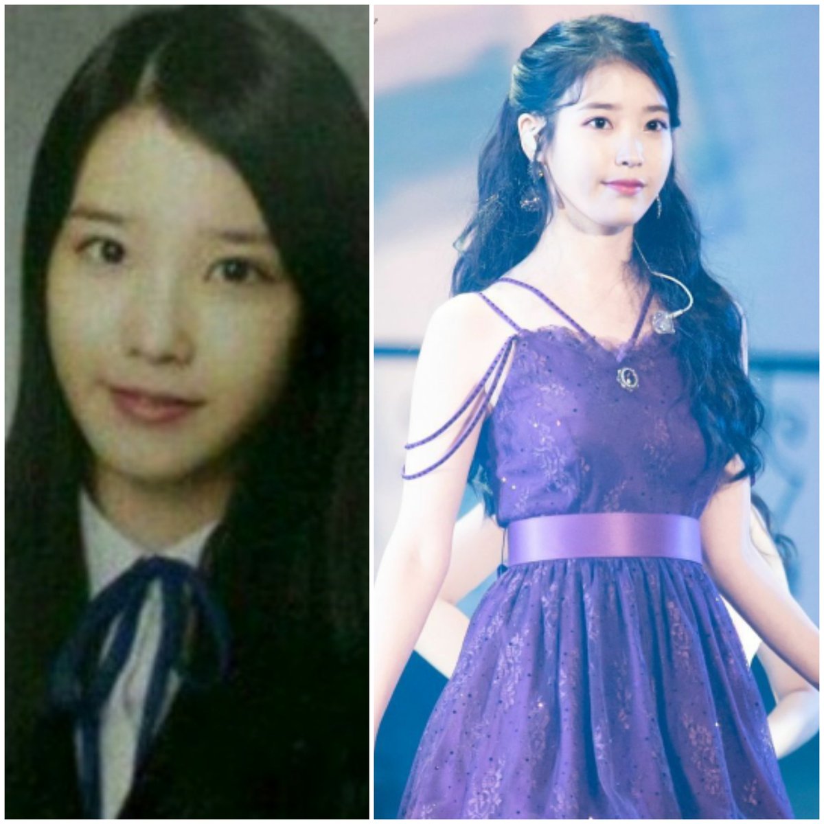 IU✨❤️: Before. After