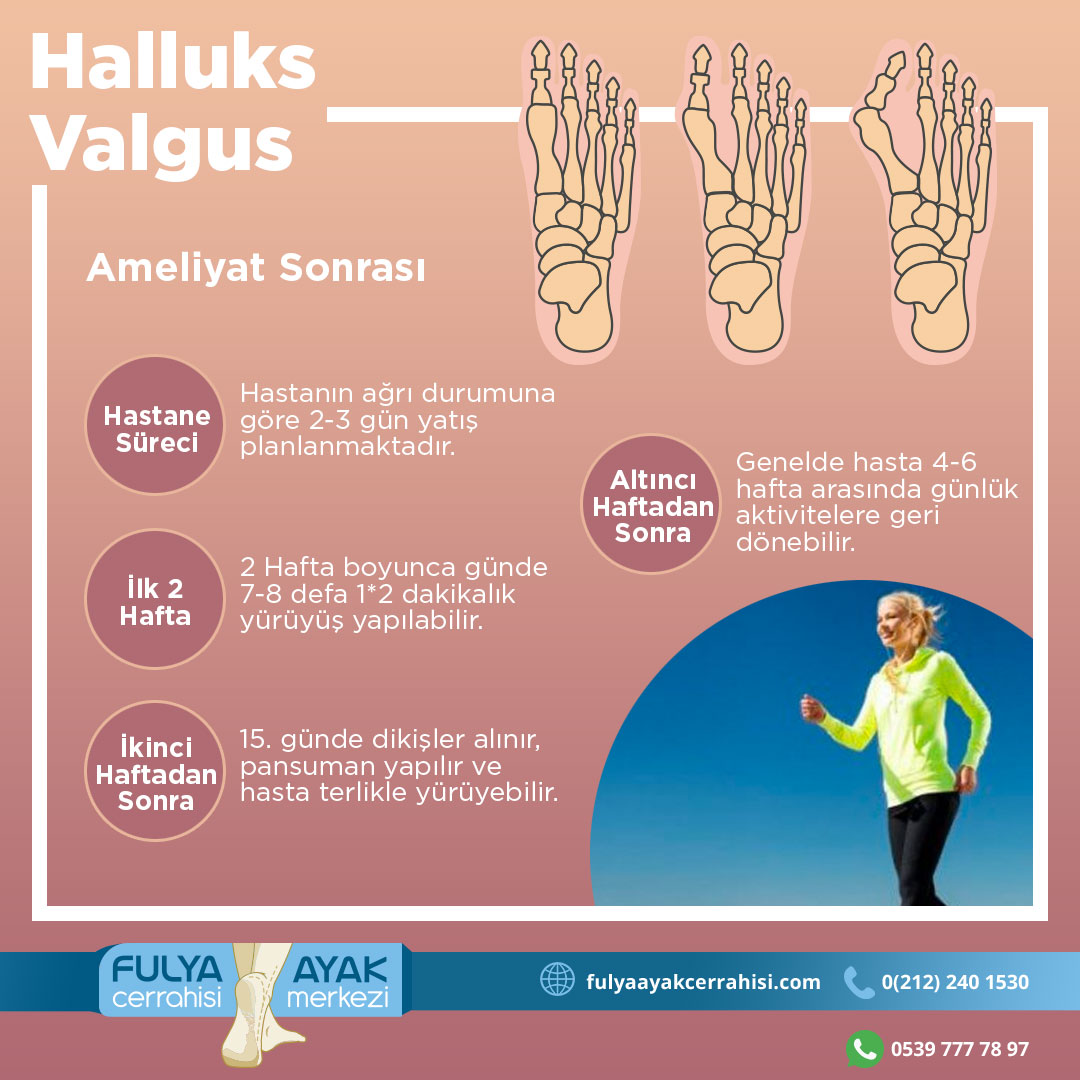 FulyaAyak's tweet photo. Ameliyat Sonrası 👠
Hastane Süreci: Hastanın ağrı durumuna göre 2-3 gün yatış planlanmaktadır.
İlk 2 Hafta: 2 Hafta boyunca günde 7-8 defa 1*2 dakikalık yürüyüş yapılabilir.
İkinci Haftadan Sonra: 15. günde dikişler alınır, pansuman yapılır ve hasta terlikle yürüyebilir. https://t.co/1HT6fdouzS
