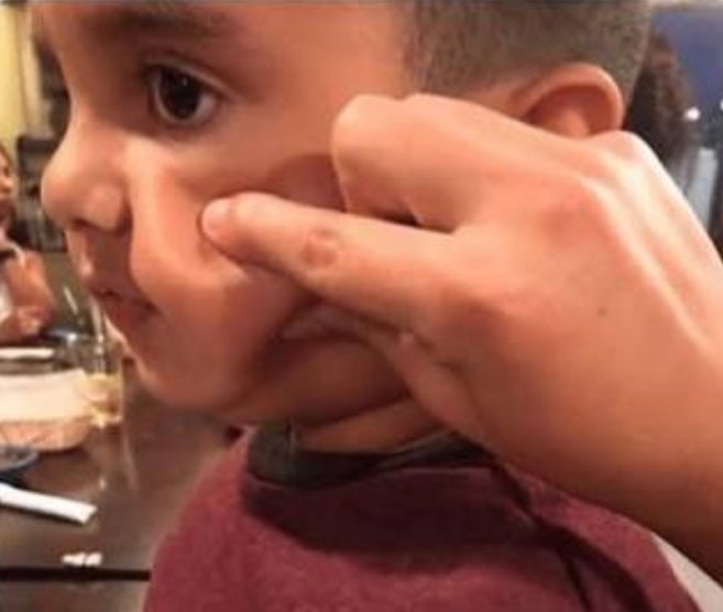 IshitaBatra15's tweet image. Growing up with chubby cheeks
everyone did this to you.. 
#hatethis #chubbybaby #cheeky❤