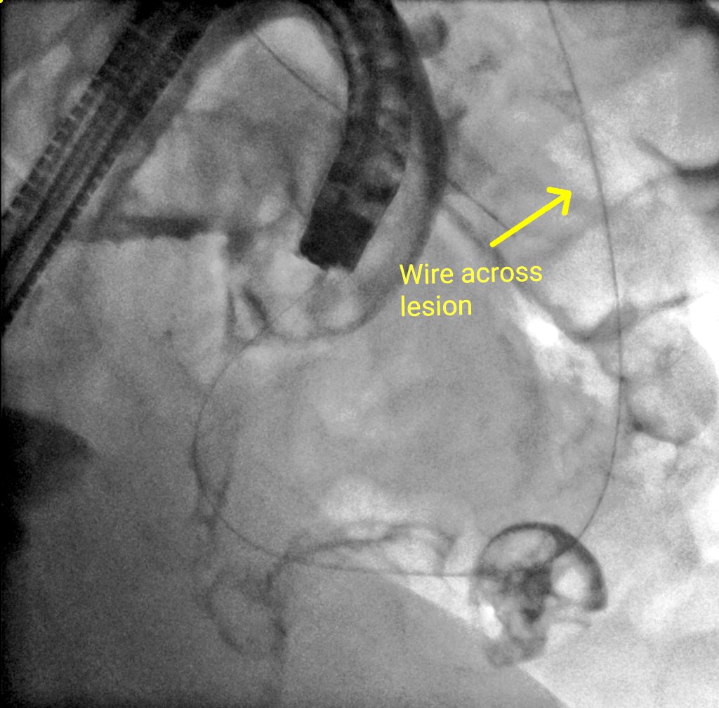 The British Society of Interventional Radiology tweet media
