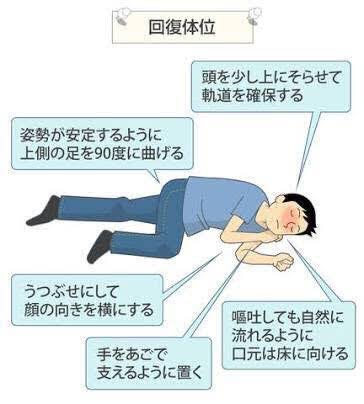 回復体位 意外と回復体位って日常で役に立つから皆も覚えておこうね Togetter 回復体位 意外と回復体位って日常で役に立つから皆も覚えておこうね Togetter