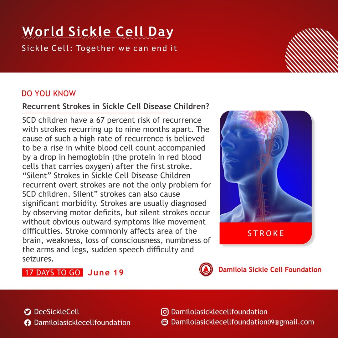 DeeSickleCell's tweet photo. Did you know stroke also affect patients living with sickle cell anemia.
#DSCF
#BreakTheSilence 
#Breakinglimits 
#breakthestigma https://t.co/mIB353Amo8