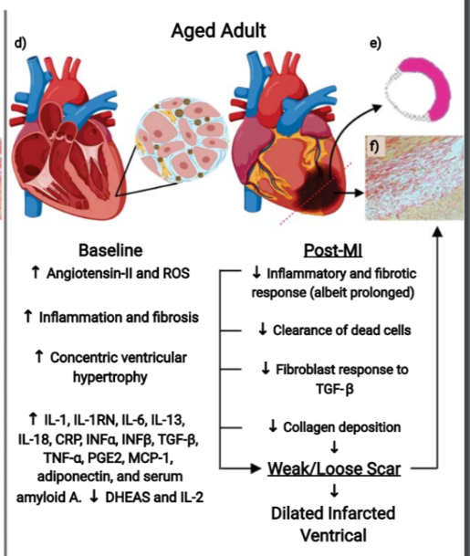AJPCellPhys's tweet photo. @AJPCellPhys Interesting review on Aging and #Cardiac Tissue Remodeling. Read full paper https://t.co/tGfA6pYDA1 https://t.co/cf0wbKgHUs