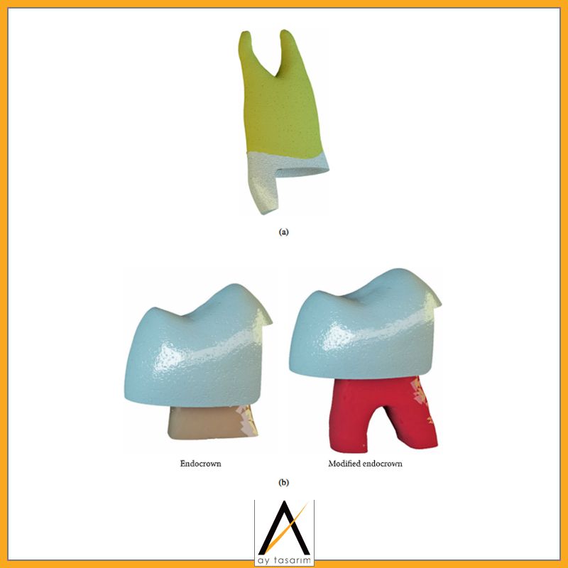 aytasarim's tweet image. Teknik destek sağladığımız yüzlerce bilimsel çalışmadan biri:
Çalışma Adı: Farklı CAD/CAM ile Endocrown Restorasyonlarının etkisi. 3D Sonlu Eleman ve Weibull Analizleri
Doktor Adı: Laden Gulec, Nuran Ulusoy
#implantology #finiteelementmethod #finiteelementanalysis #finiteelement