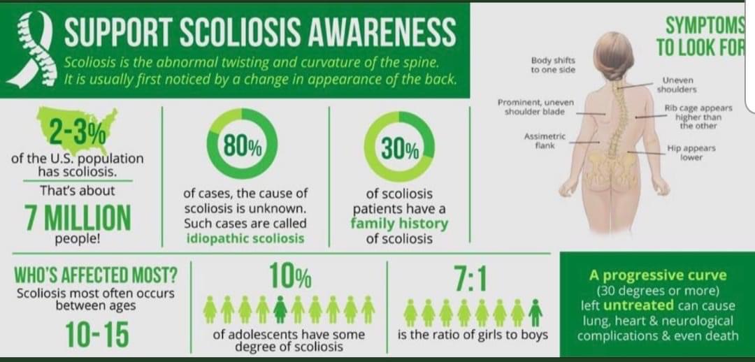 AlcesterHealth's tweet image. 💚 June is Scoliosis Awareness Month 💚

Read below to educate yourselves on what it means to have scoliosis ⬇️