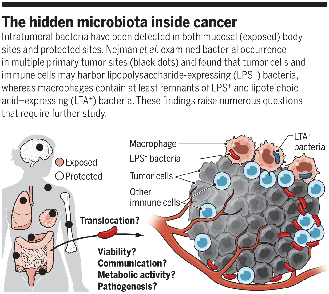 Science Magazine On Twitter Bacteria Are Widespread In Tumors Are Found Within Cells And Differ By Cancer Type According To The Most Rigorous And Comprehensive Survey Of Bacteria In Human Tumor Samples