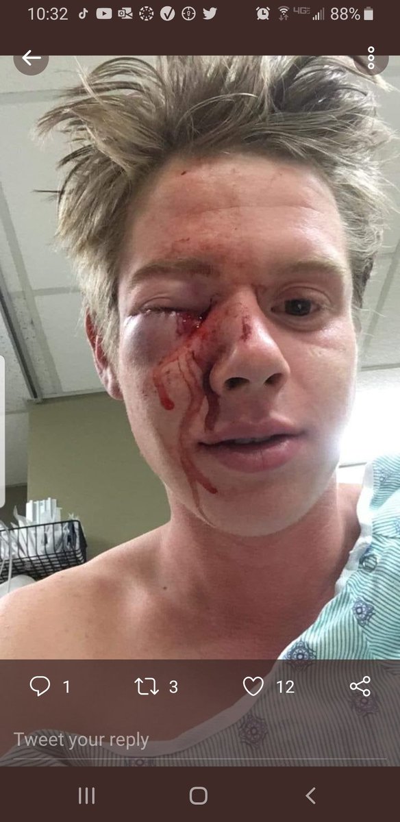 Urupglop - BLM tweet media