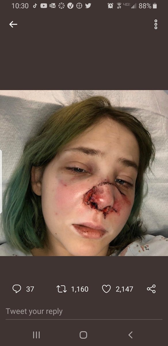 Urupglop - BLM tweet media