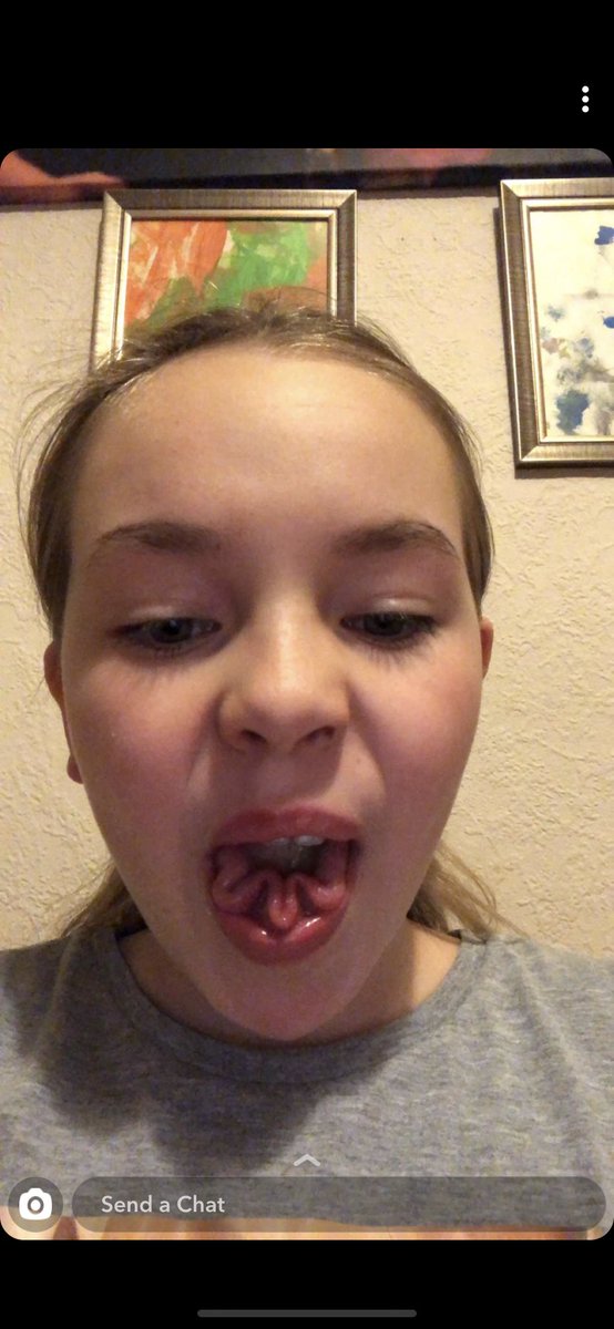jac110482's tweet photo. @AleshaOfficial my 10 year old daughter Peyton can do this with her tongue also 🤣 https://t.co/OphRXpXvZf