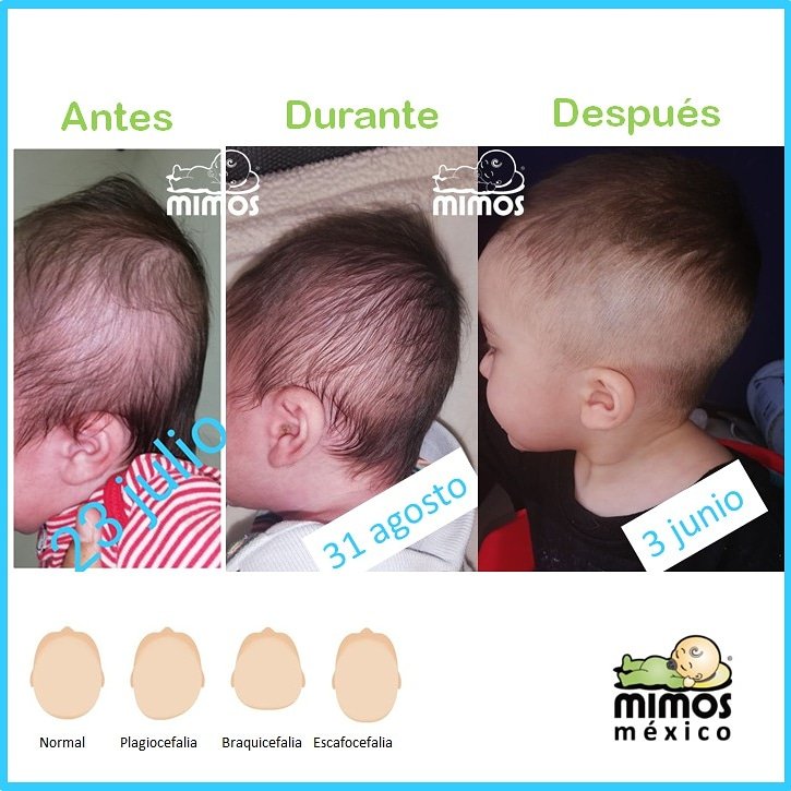 Cojin Mimos Mexico on X: Les compartimos este avance que nos compartió  amablemente una mami. Es un gusto para nosotros poderlos apoyar en el  cuidado de sus bebés. #cojinmimos #cojinmimosmexico #mimospillow  #cabezaplana #