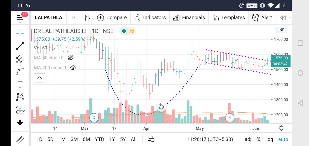 iDavinderK's tweet image. #NewPosition- Long #LalPathLabs at 1561

#Stocomotive
#LalPath