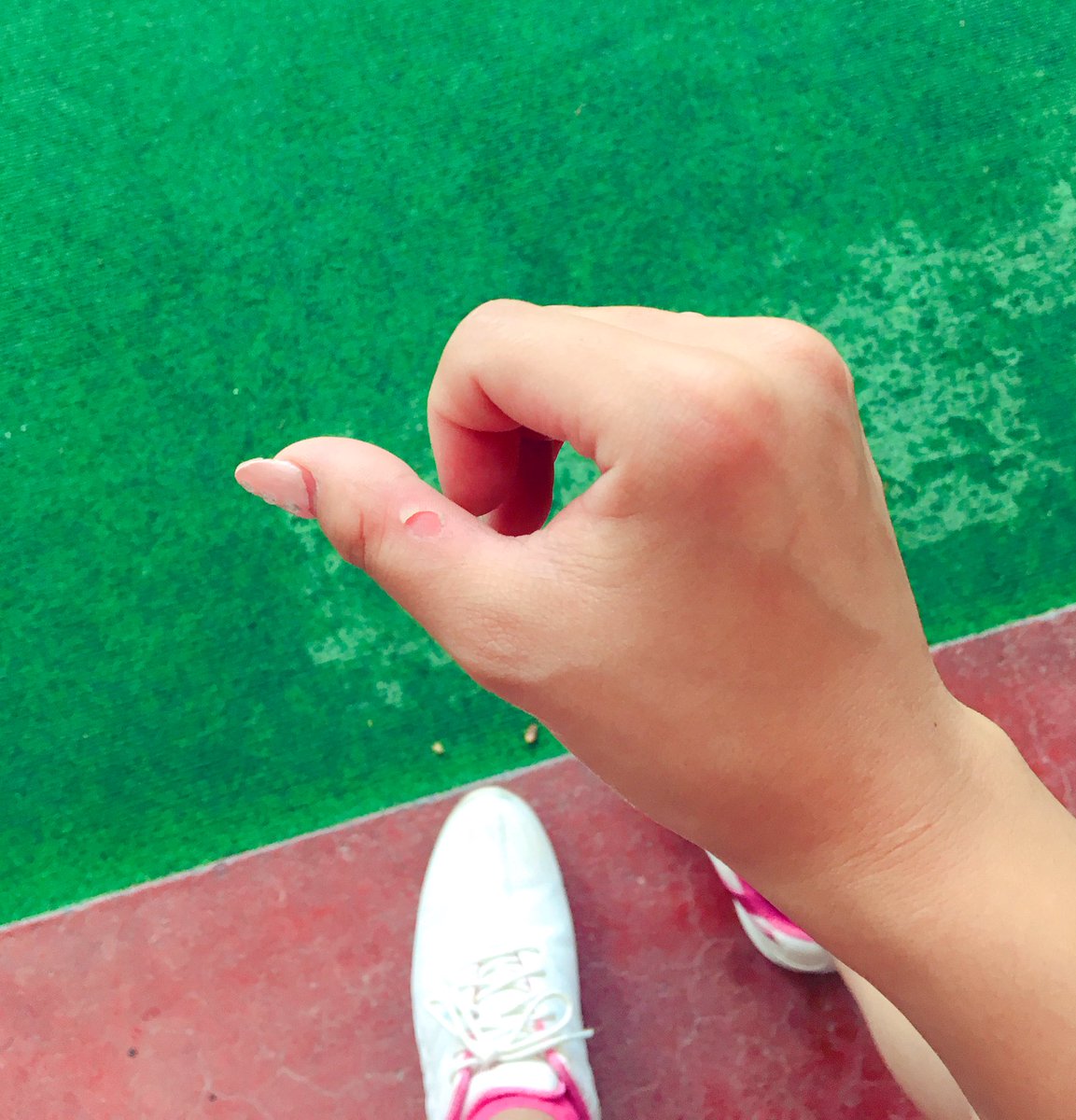 まちこ 今日もゴルフ グローブ無しでやったら両手の皮むけた