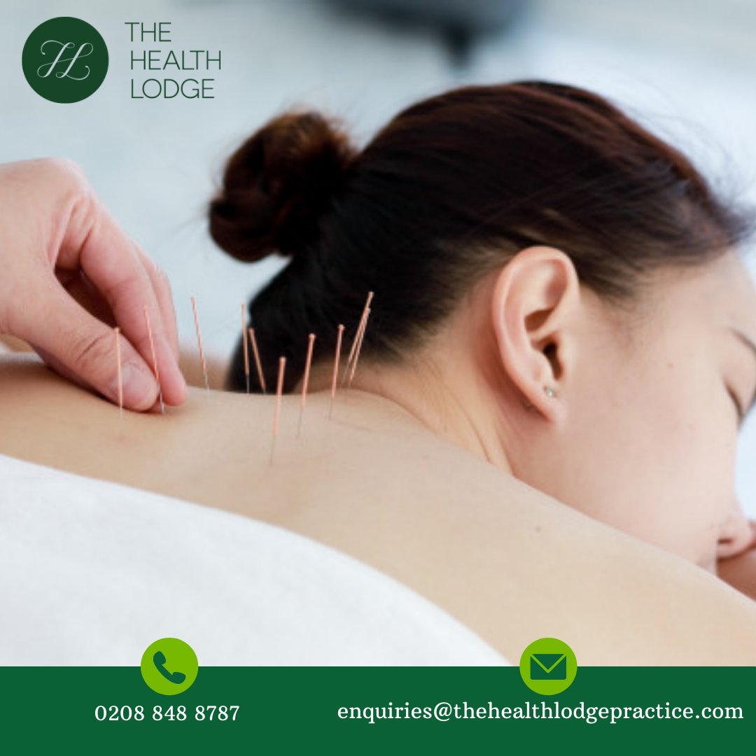 Did you know that acupuncture can relieve eye strain that is often connected to neck tension?

Contact us for details:
enquiries@thehealthlodgepractice.com
02088488787

#lowerbackpain #thehealthlodge #chiro #chiropractic #chiropractors #relax #physicaltherapy #physiotherapy