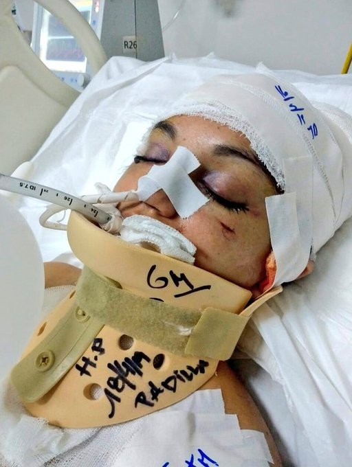 Este es Luis Ernesto Rondón/ así dejó a Fátima Aparicio en Tucumán
Que no quede libre!!, que la Justicia se haga cargo!!
Es un femicida!!, quiere terminar de matarla!!
Compartir su cara, que llegue a los jueces/as en toda Argentina

Por Fátima 💜
#NiUnaMenos