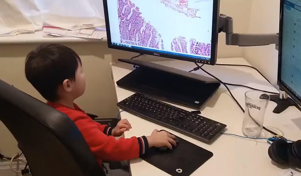 Dingdingading's tweet photo. Kudos to this dude who spent 2 days scanning these slides of almost 200 different diseases to help inspiring future #pathologists, stay tuned if you would like to access this collection. 😀

#pathology #digitalpathology #ai #MedTwitter #STEM #STEMeducation https://t.co/j4Gsga095z