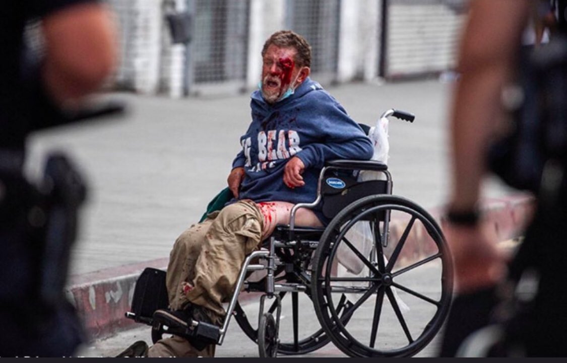As a Boston Irish kid who grew up in the ‘70s and ‘80s, I remember the sordid role that rubber bullets played during The Troubles. So it’s shocking to watch Americans shoot fellow (homeless, wheel-chaired) Americans in the face with them. This shit in LA should disturb you.