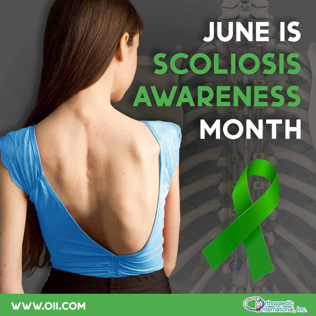 OII_ortho's tweet photo. June is SCOLIOSIS AWARENESS MONTH! Consult your orthopedic doctor and discuss your treatment options. We can refer you to our partner doctors for check up. Send us a message or call us at 0999-915-7791 or 0977-635-7461.

#ScoliosisAwareness #FightScoliosis https://t.co/pMiibbiJRl