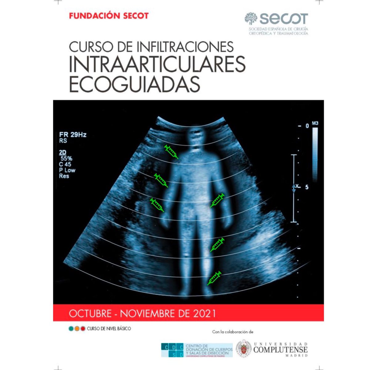 🔵Curso de Infiltraciones Intraarticulares Ecoguiadas🔵

➡️Organiza: Fundación SECOT 
<a href="/secotsecot/">@secotsecot</a> 

➡️Dirigido a: Especialistas y Residentes COT 

➡️Socios SETRADE y SECOT 
✍🏻Inscripción Gratuita

+info: setrade.org/eventoss/infil…