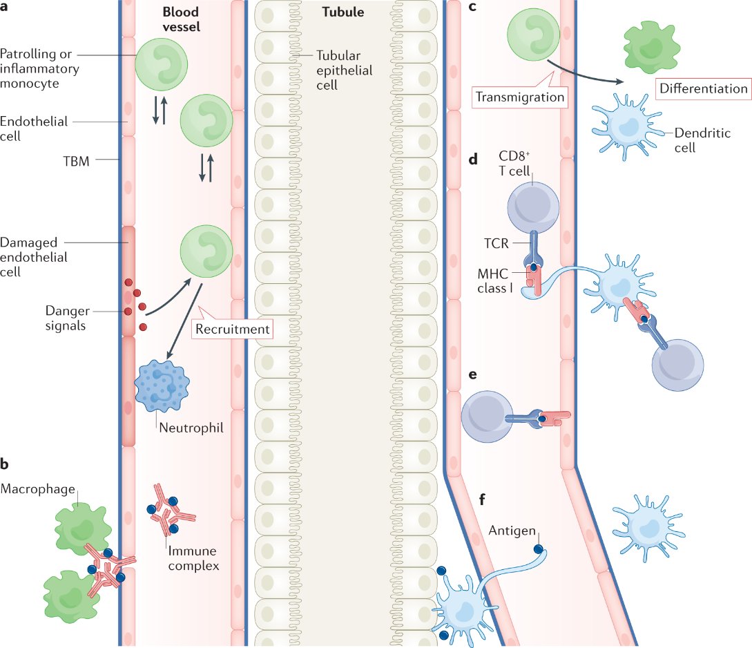Nature Reviews Nephrology (@natrevneph) on Twitter photo New online! <a href="/KitchingLab/">Kitching Laboratory</a> and <a href="/MHickey_IVM/">Michael Hickey</a> describe how in vivo imaging has advanced our understanding of immune cell behaviour and dynamics in the kidney go.nature.com/2ZrmMJB
<a href="/MonashCID/">MonashCID</a> <a href="/SCSMonash/">Monash University School of Clinical Sciences</a> <a href="/MonashUni/">Monash University</a> New online! <a href="/KitchingLab/">Kitching Laboratory</a> and <a href="/MHickey_IVM/">Michael Hickey</a> describe how in vivo imaging has advanced our understanding of immune cell behaviour and dynamics in the kidney go.nature.com/2ZrmMJB
<a href="/MonashCID/">MonashCID</a> <a href="/SCSMonash/">Monash University School of Clinical Sciences</a> <a href="/MonashUni/">Monash University</a>