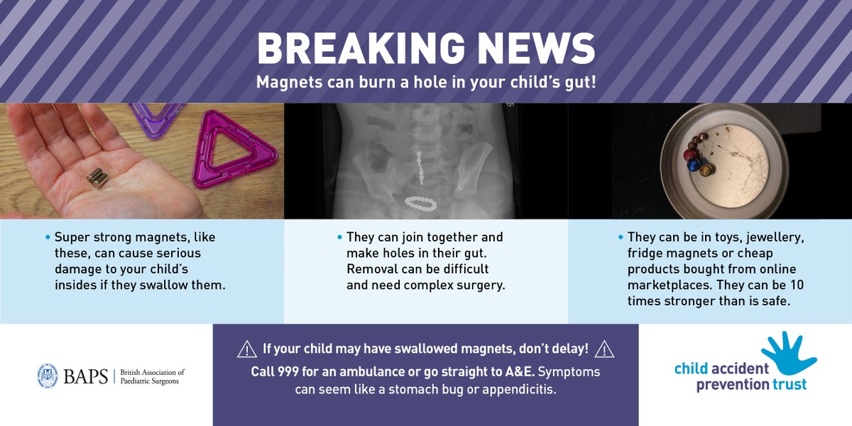 CAPTcharity's tweet photo. Doctors warn: growing numbers of children harmed by super-strong magnets. “If swallowed, the magnets can stick together in the child’s intestines or bowels. This can cause significant damage within hours.” Please share https://t.co/WR84ToWjsw #magnetsafety @bapscampaigns https://t.co/Pmw26lCaiM