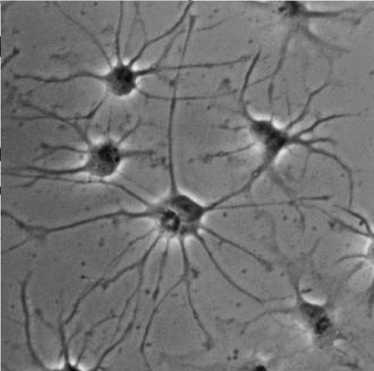 CRISPRbrain's tweet image. @CRISPRbrain is welcoming a new cell type: the #astrocyte! Check out the new datasets at CRISPRbrain.org. And try out our recently added features to explore CRISPR screens with single-cell RNA-seq readouts (UMAP, cluster views...)! We look forward to your feedback.
